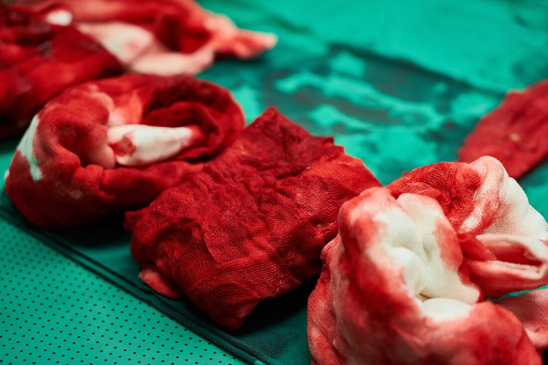 Gemäß einem Bericht von www.nordkurier.de, Autofahrer in Deutschland müssen sich laut dem Präsidenten des deutschen Versichererverbands GDV, Norbert Rollinger, darauf einstellen, dass die Beiträge für Kfz-Versicherungen im nächsten Jahr voraussichtlich um durchschnittlich zehn Prozent steigen werden. Diese Prognose basiert auf den gestiegenen Kosten für Reparaturen und Ersatzteile, die den Versicherern im Jahr 2023 einen Milliardenverlust bescherten. Die Kfz-Versicherer haben daraufhin bereits zum Jahreswechsel die Preise angehoben, um die Verluste auszugleichen. Die Auswirkungen dieser Beitragssteigerungen sind für die Verbraucher offensichtlich &#8211; höhere Kosten für Kfz-Versicherungen. Für die Branche bedeutet dies eine Möglichkeit, die Verluste auszugleichen und langfristig in die schwarzen Zahlen &hellip;